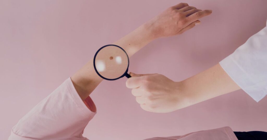 A dermatologist using a magnifying glass to closely examine a mole on a patient’s forearm against a soft pink background.